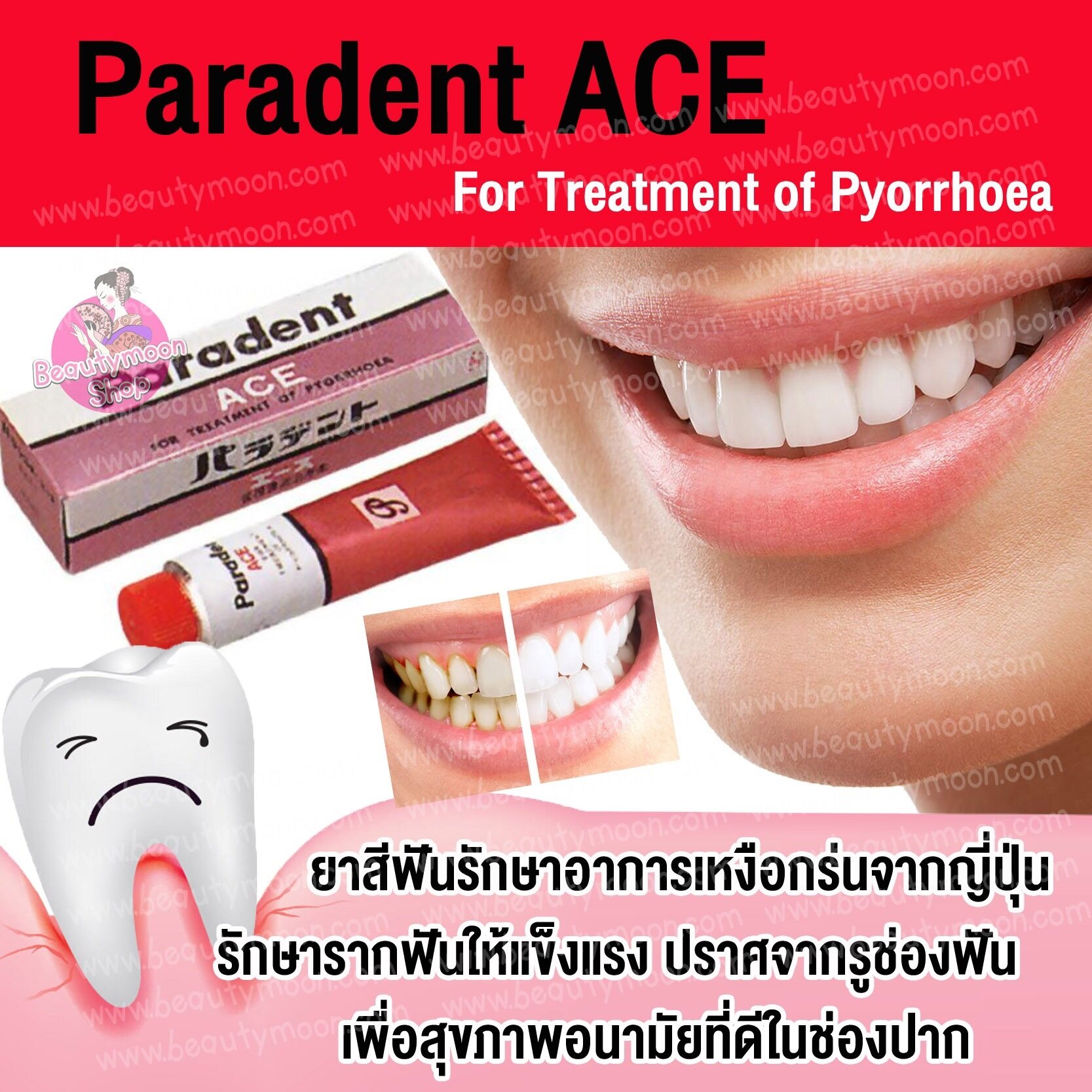 🦷Paradent ACE For Treatment of Pyorrhoea ยาสีฟันรักษาอาการเหงือกร่น