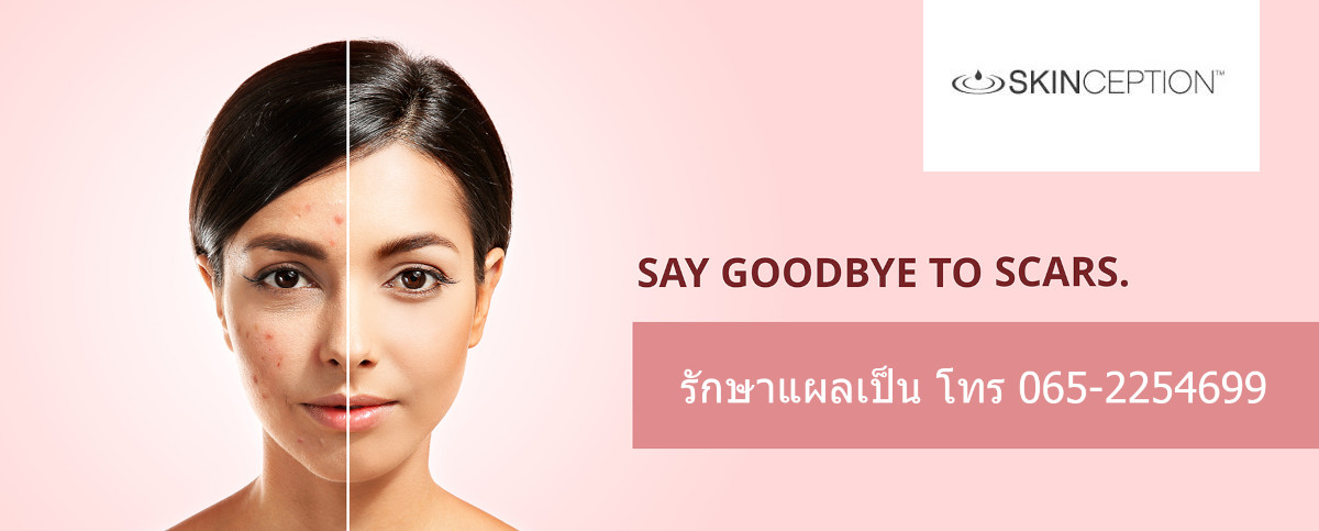 ลบรอยแผลเป็น เห็นผลใน 4 สัปดาห์ อันดับ #1 จากอเมริกา