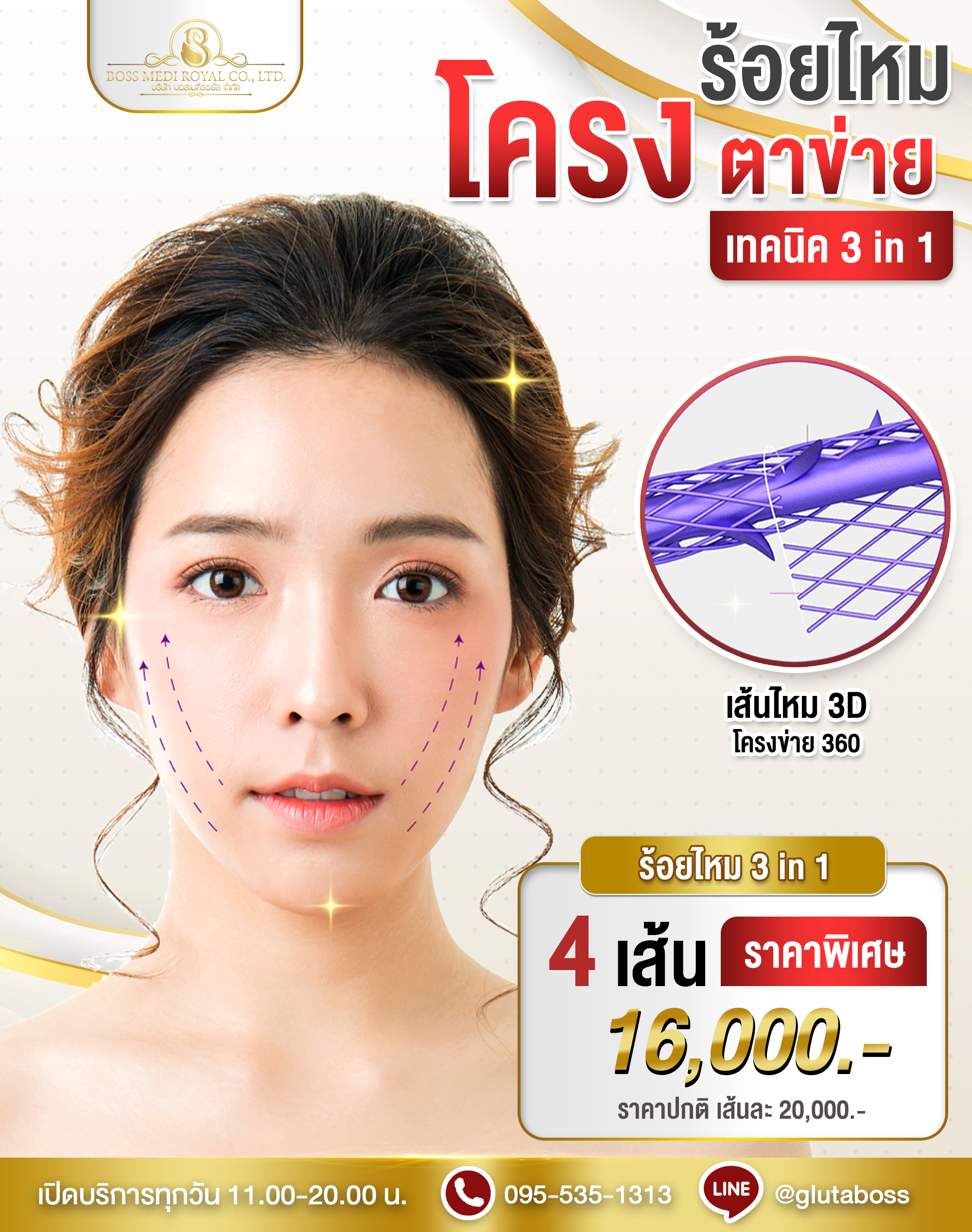 ร้อยไหมโครงตาข่าย