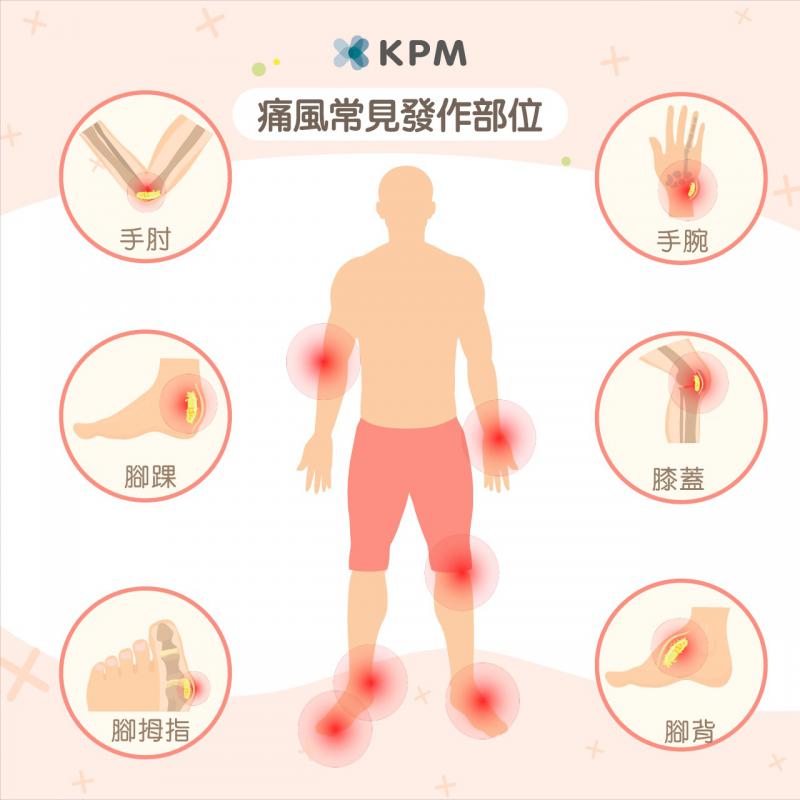 Kobayashi Uric Acid Help อาหารเสริมลดกรดยูริกจากญี่ปุ่น