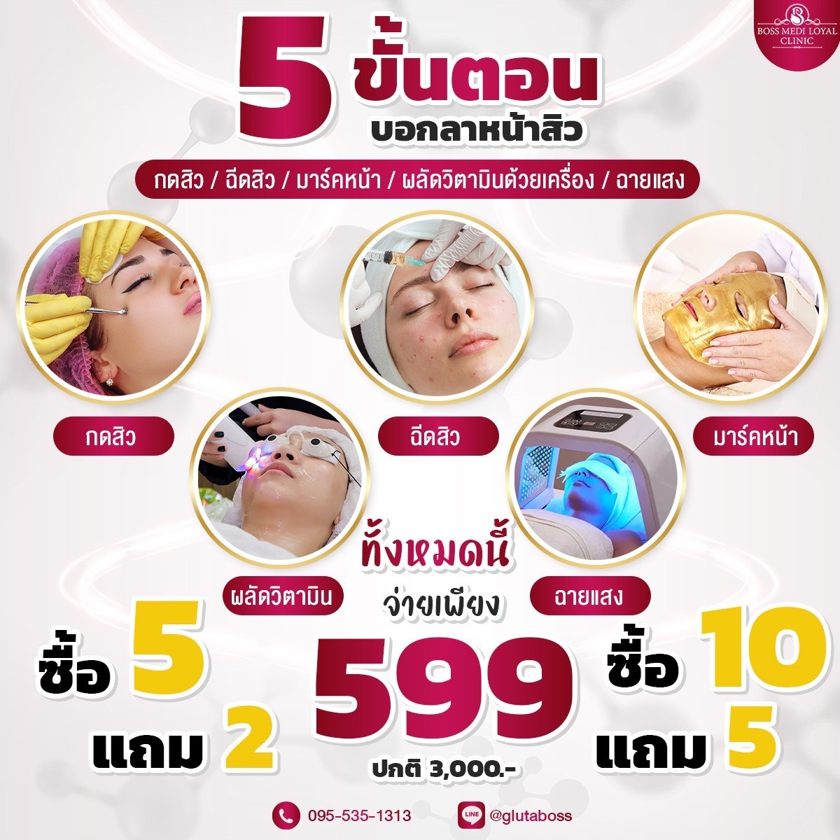 ทรีนเม้นหน้า Acne Clear รักษาสิว 5 ขั้นตอน เคลียร์ผิวใส ไร้สิว