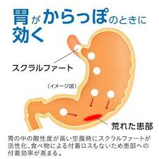 Sucrat gastrointestinal medicine อาหารเสริมลดกรดในกระเพาะอาหารจากญี่ปุ่น