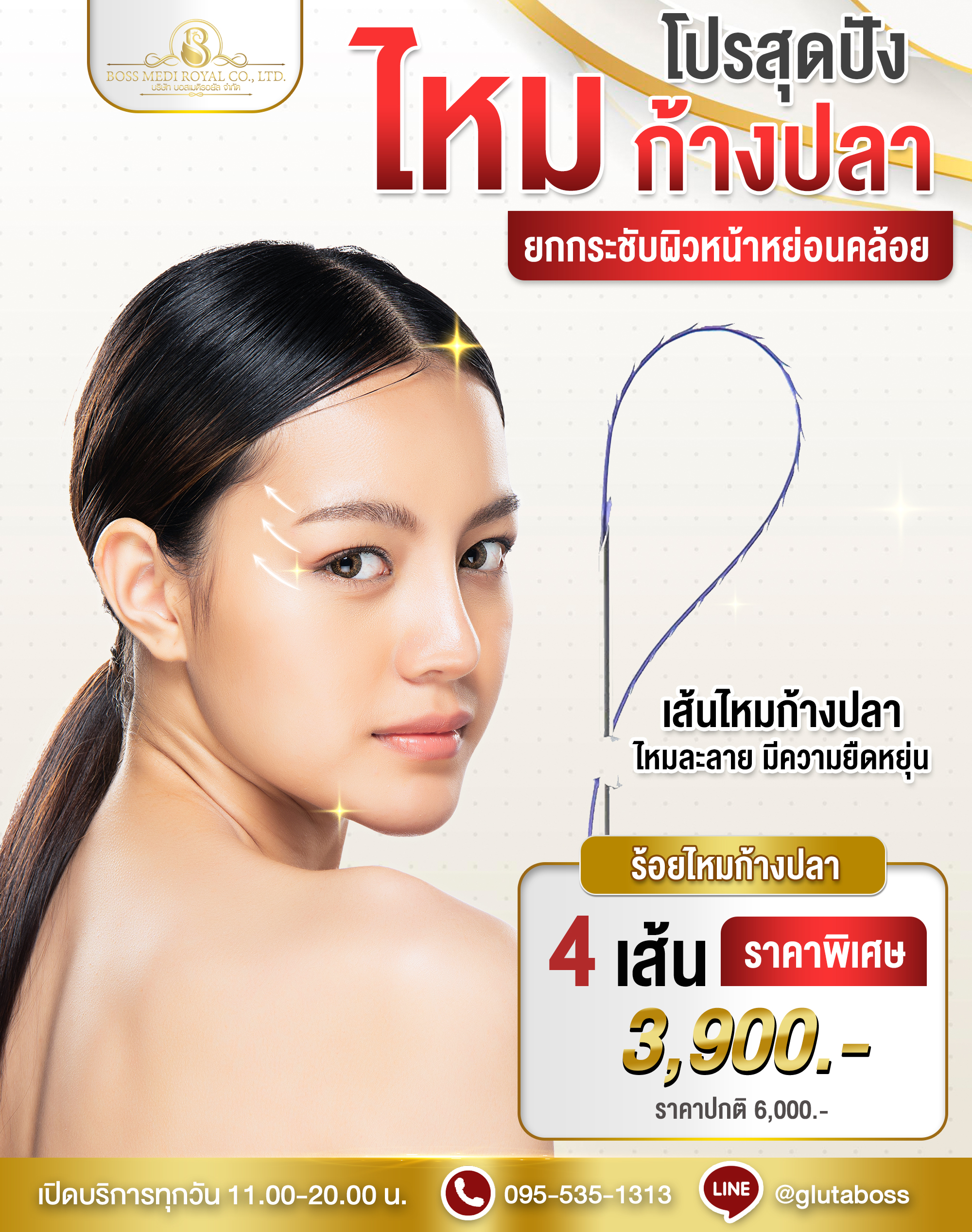 ร้อยไหมก้างปลา