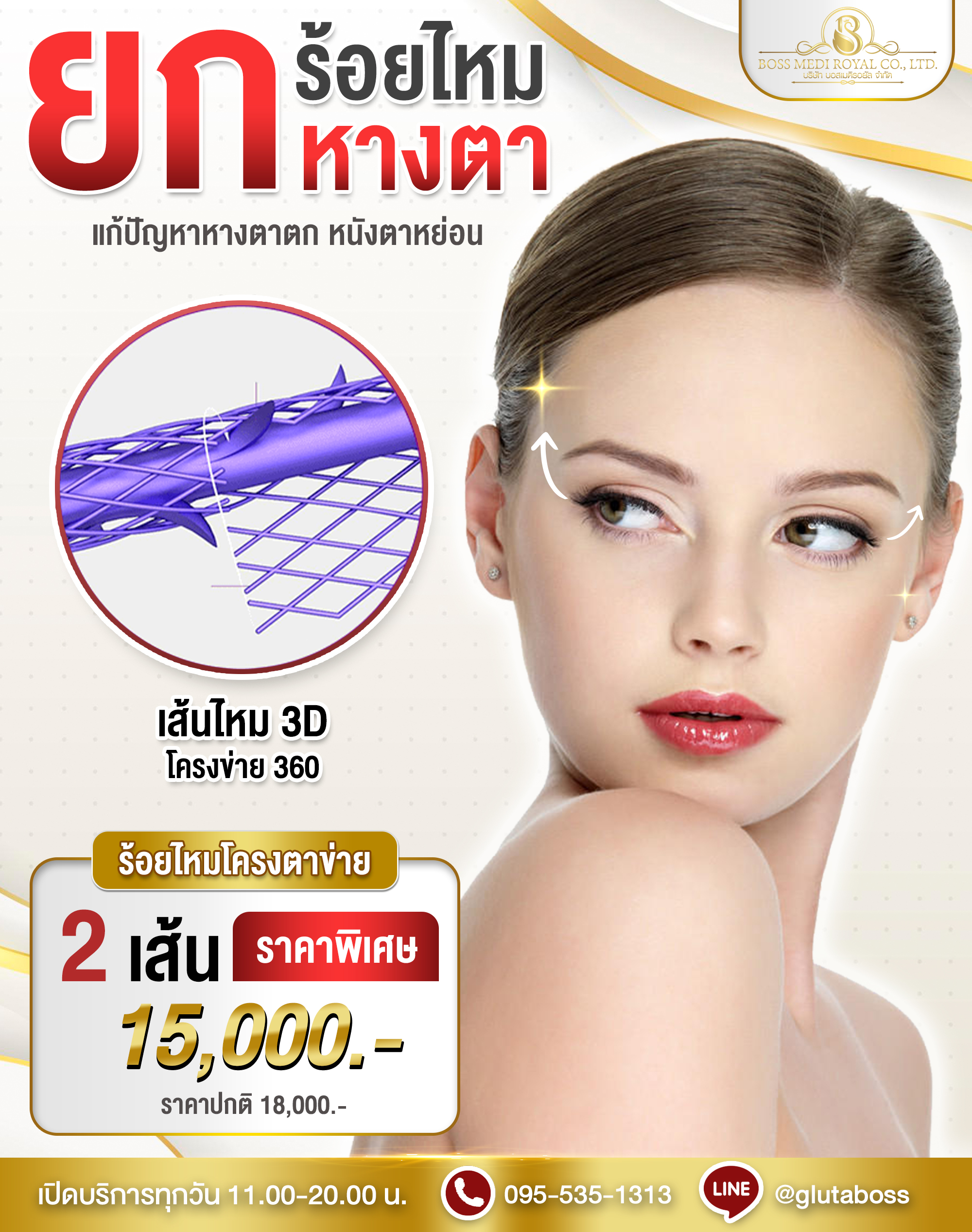 ร้อยไหมยกหางตา