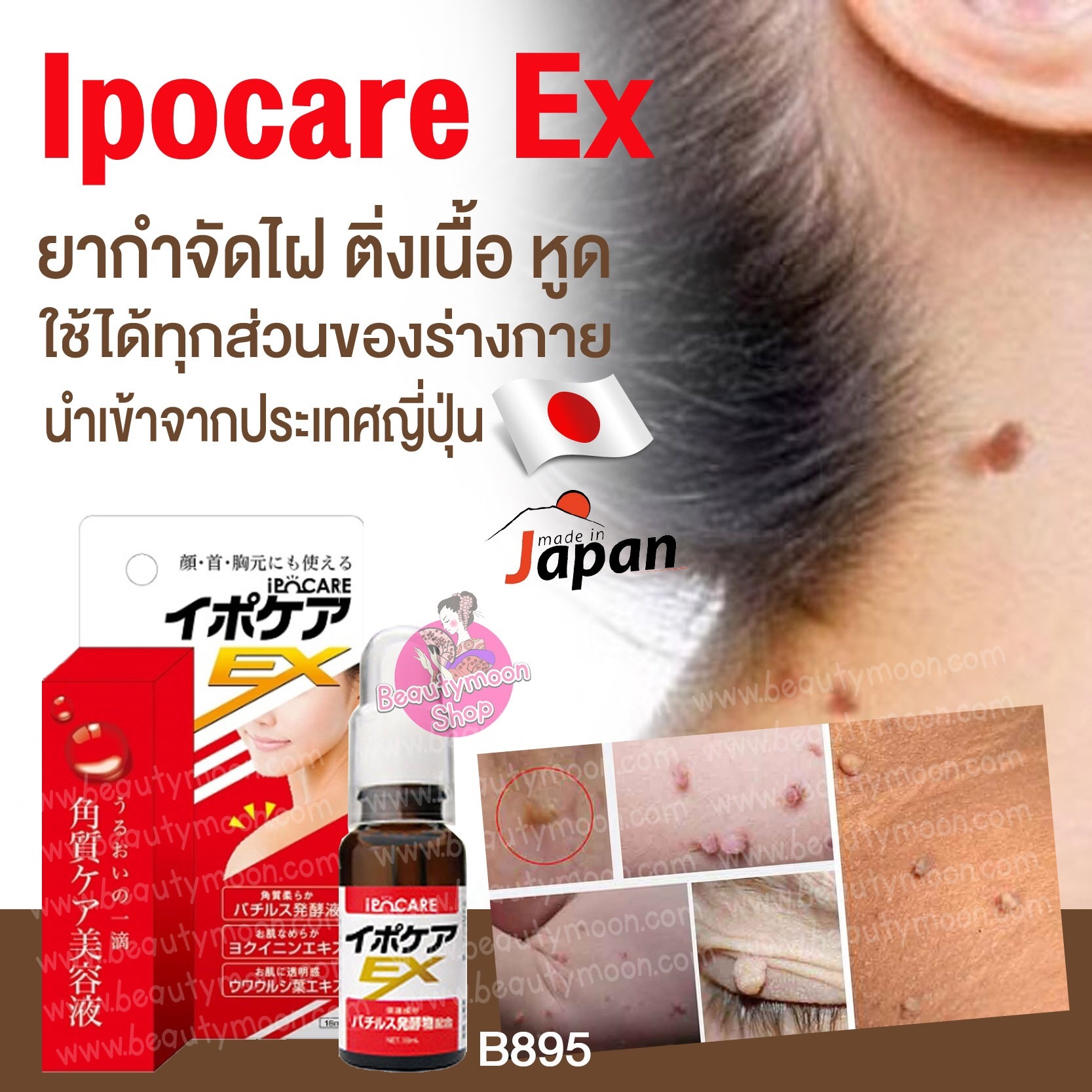 Ipocare Ex เจลแต้มไฝ ติ่งเนื้อ หูด อ่อนโยนใช้ได้แม้กระทั่งบริเวณใบหน้า คอ หน้าอก หรือลำตัว