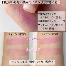 Omi Brothers Menturm Medicated Moist Lip Rose Pink ลิปเปลี่ยนสี มอยส์ลิปสีชมพูแดงผสมแร่ธาตุน้ำพุร้อน บำรุงฝีปากให้ชมพูแดงๆ สดใสน่ารักสุดๆ